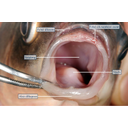 Kárász csökevényes nyelve a szájfenéken