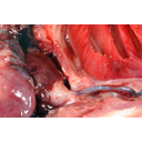 A szívbıl kilépő artériás törzs (felszálló aorta)