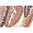 Orsógiliszta testkeresztmetszet-részletének fénymikroszkópos képe
