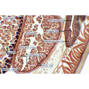 Orsógiliszta testkeresztmetszet-részletének fénymikroszkópos képe