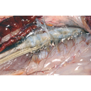 A gerincoszlop környéke a leszálló aortával, a gerincvelőidegekkel és a szimpatikus törzzsel