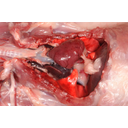 A mellüregi szervek a csecsemőmirigy eltávolítása után