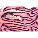 Az ondóhólyagból nyíló ondótölcsér fénymikroszkópos képe