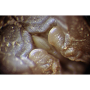Orvosi pióca állkapcsai a szájüregben. Sztereomikroszkópos fotó