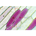 Antociántartalmú sejtek a lilahagyma bőrszövetében