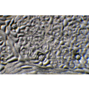 Ferde megvilágítású kép az orgona (Syringa vulgaris) levélfonáki levonatáról. Jól megfi gyelhetők a kutikula mintázata, a gázcserenyílások, a mirigyszőrök és a levélerek meg nyúlt szállítóelemei