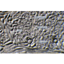 Ferde megvilágítású kép az orgona (Syringa vulgaris) levélfonáki levonatáról. Jól megfi gyelhetők a kutikula mintázata, a gázcserenyílások, a mirigyszőrök és a levélerek meg nyúlt szállítóelemei