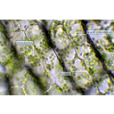 Kanadai átokhínár levélrészletének erős nagyítású fénymikroszkópos képe