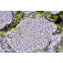 Kisvirágú nebáncsvirág (Impatiens parvifl ora) bőrszövetének mikroszkópos képe. A levelek bőrszöveti sejtjei különleges módon zöldszíntesteket tartalmaznak