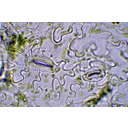 Kisvirágú nebáncsvirág bőrszövetének mikroszkópos képe gázcserenyílásokkal