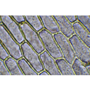 Anyósnyelv (Sansaveria cylyndica) bőrszövetének fénymikroszkópos képe. A sejtmag körül főleg fehérjékből álló, erősen fénytörő színtelen színtestek láthatók