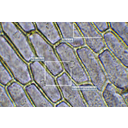 Anyósnyelv (Sansaveria cylyndica) bőrszövetének fénymikroszkópos képe. A sejtmag körül főleg fehérjékből álló, erősen fénytörő színtelen színtestek láthatók
