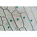Metilzölddel megfestett sejtmagvak a vöröshagyma bőrszöveti sejtjeiben