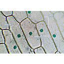 Metilzölddel megfestett sejtmagvak a vöröshagyma bőrszöveti sejtjeiben
