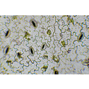 Muskátli levéltépéssel készült fonáki bőrszövetének fénymikroszkópos képe. A hullámos falú bőrszöveti sejtjei között a gázcserenyílások elszórtan láthatók, a melléksejtek itt is hiányoznak