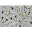 Muskátli levéltépéssel készült fonáki bőrszövetének fénymikroszkópos képe. A hullámos falú bőrszöveti sejtjei között a gázcserenyílások elszórtan láthatók, a melléksejtek itt is hiányoznak