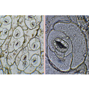 Bablevelű varjúháj (Sedum telephium) bőrszöveti nyúzatának mikroszkópos képei anizocitikus légzőapparátusokkal