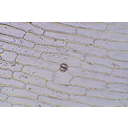 A vöröshagyma allevél bőrszövetének fénymikroszkópos képe egy gázcserenyílással