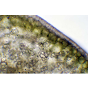 Fénymikroszkópos metszet a bab töpörödő szikleveléből