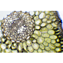 Lucfenyő (Picea abies) tűlevél-keresztmetszetének fénymikroszkópos képe. Az epidermisz alatt a hipodermiszt látjuk, amit a fotoszintetizáló klorenchima követ. A központi részt az egyrétegű endodermisz veszi körül. Belül a szállítónyaláb keresztmetszete látható. A nyalábban elkülönül a farész és a háncsrész. A központi részt a transzfúziós szövet tölti ki