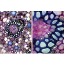 A gyöngyvirág rizóma keresztmetszete, toluidinkékkel megfestett preparátum fénymikroszkópos képe