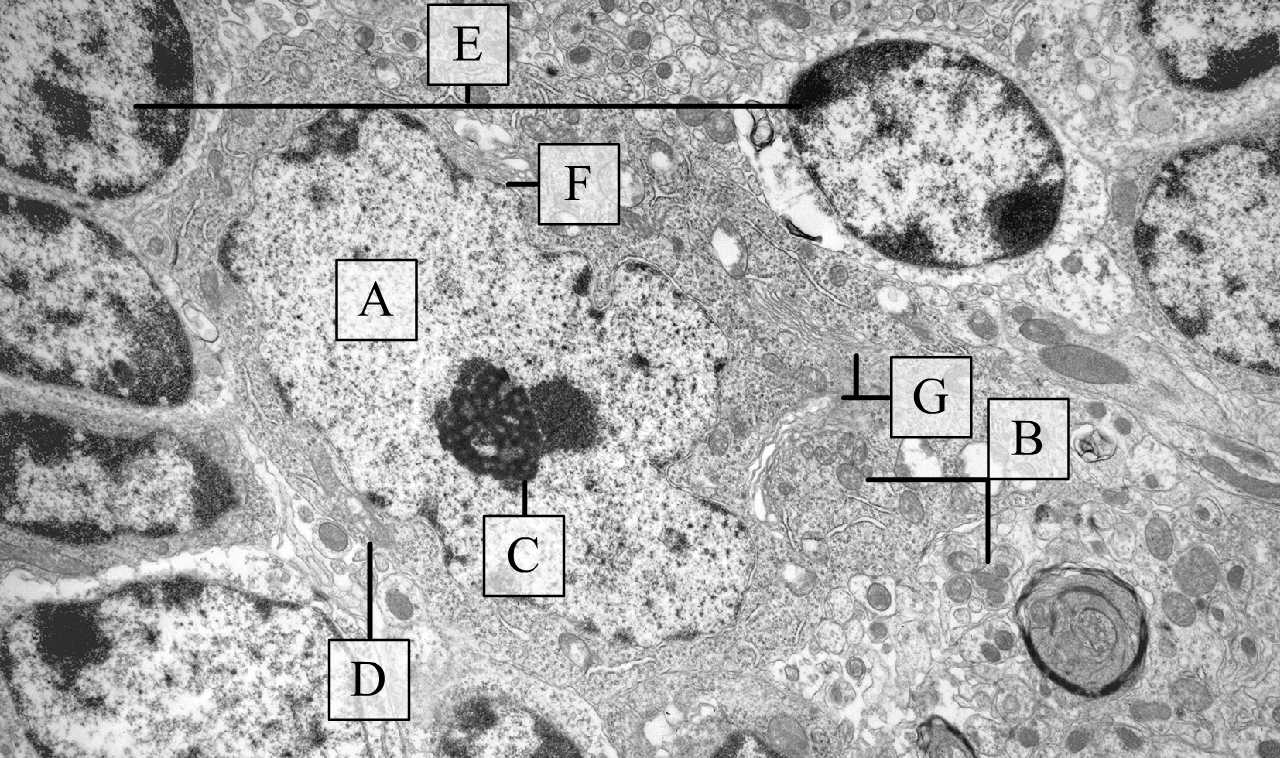 Egy Purkinje sejt és környezete EM metszeten kis nagyítással