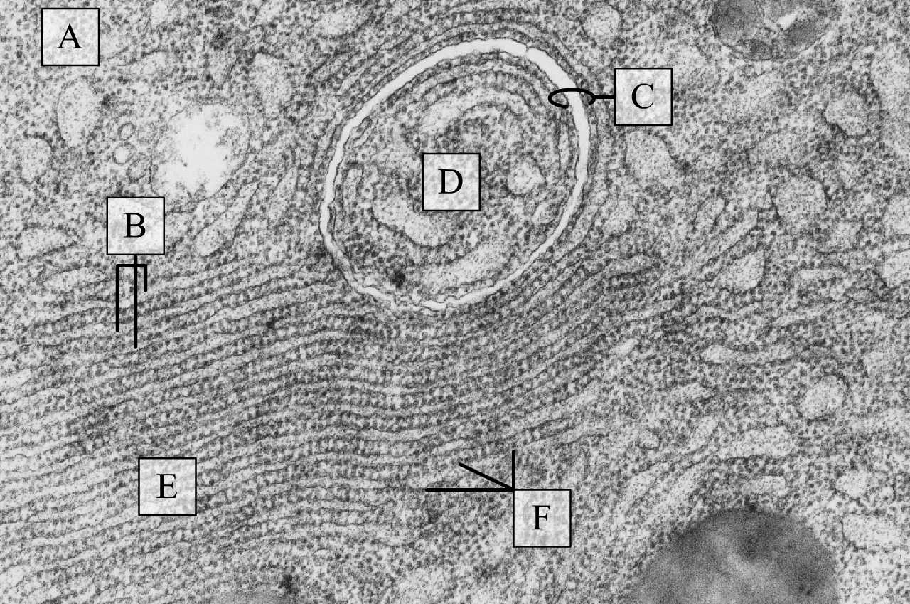 Durva felszínű endoplazmás hálózat intenzív fehérjeszin té zist folytató sejtben