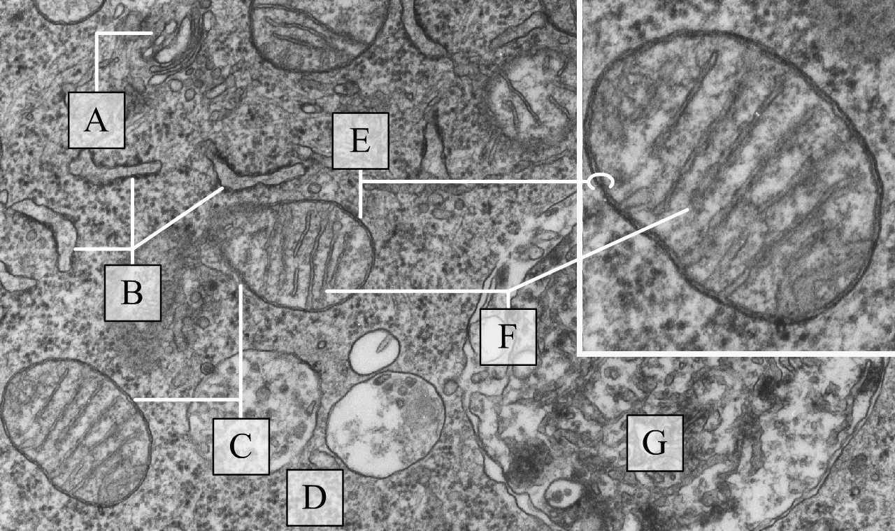 Szép megjelenésű mitokondriummetszetek lemezes belső membránrendszerrel