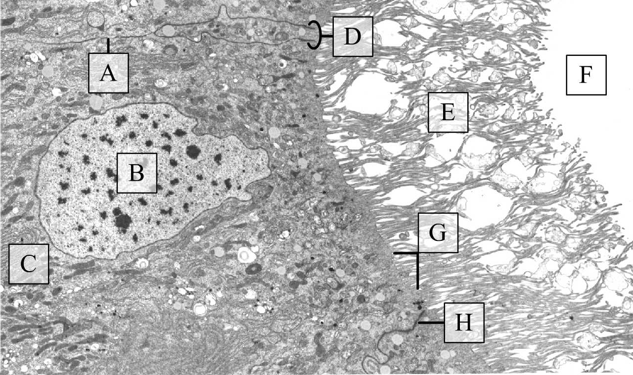 Bélhámsejt csúcsi része mikrobolyhokkal és sejtkapcsoló szerkezetekkel