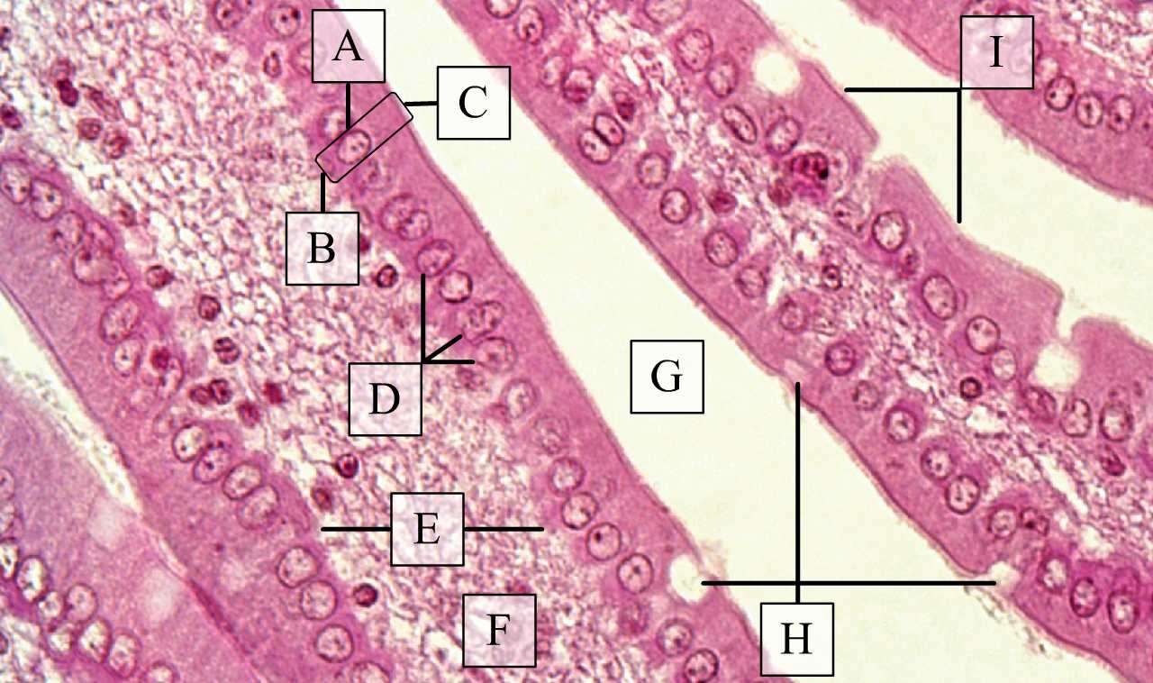 A hámszövet sejtjeinek elhelyezkedése, a sejtek felszíneinek irányultsága és a csúcsi membránfelszín egyik módosulása (bélboholy kefe szegélyes henger hámja) (H-E, Zboray Géza metszete)