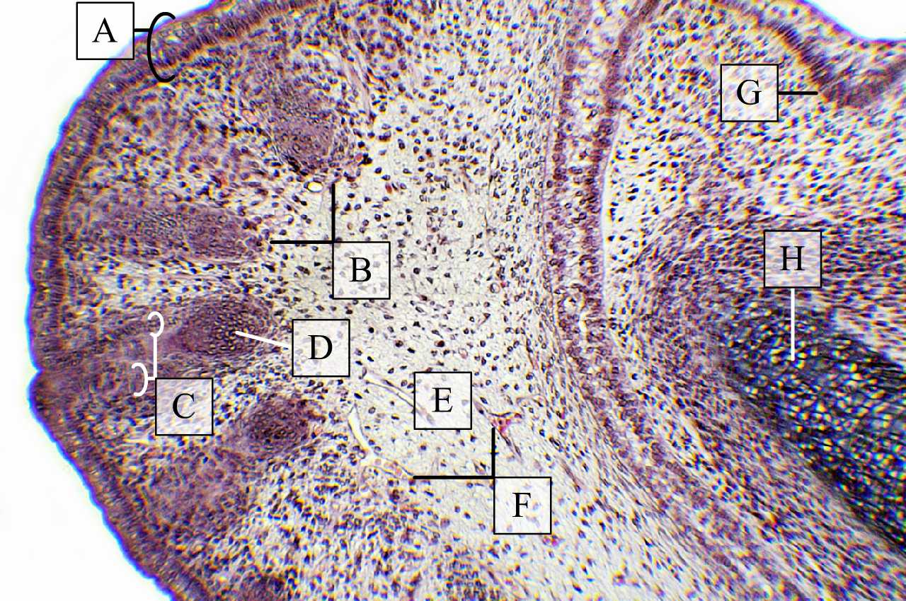 Mezenchimális kötőszövet újszülött patkány metszetén (állkapocs részlete) (H-E, Zboray Géza metszete)