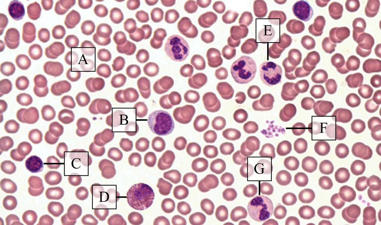 Vérsejtek 40×-es objektívvel látható képe vérkenetben (Zboray Géza preparátuma)
