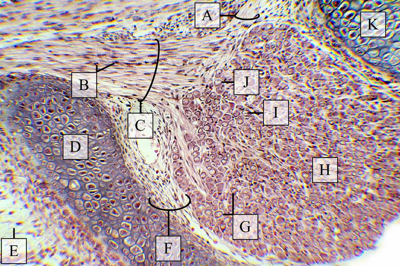 Embrionális üvegporc újszülött patkány gerincoszlopának csigolyáiban (H-E, Zboray Géza metszete)
