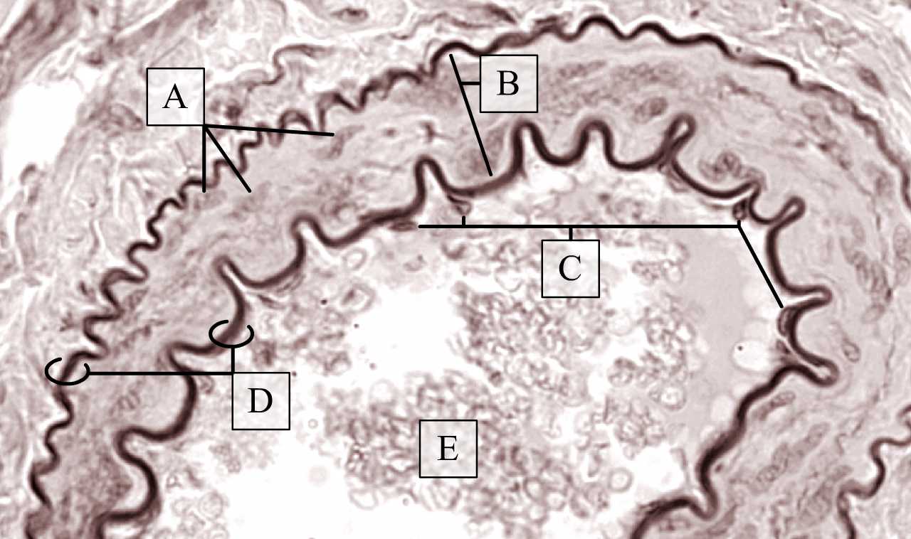 Orceinnel kimutatott rugalmas rostos lemezek kis artéria falában nagy nagyításon (Zboray Géza metszete)