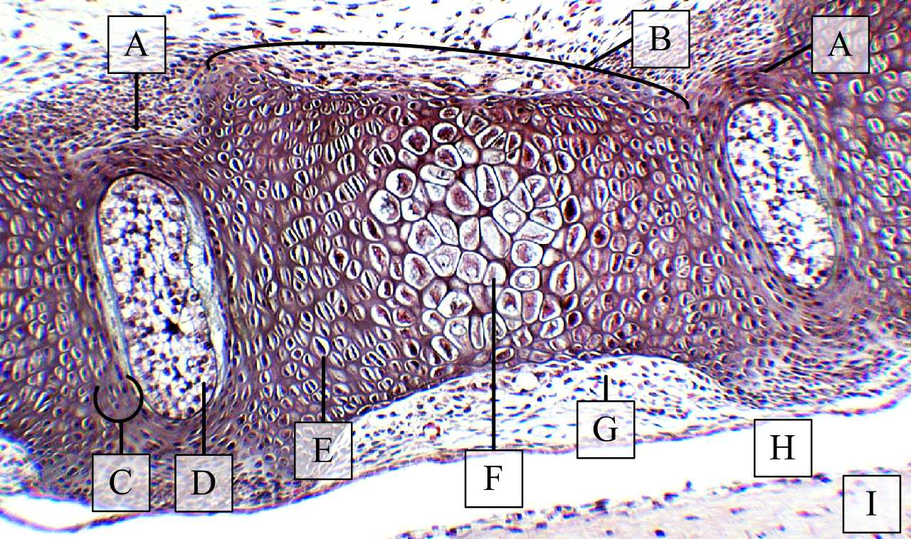 Csontosodó csigolya két fejlődő porckorong között (H-E, Zboray Géza metszete)
