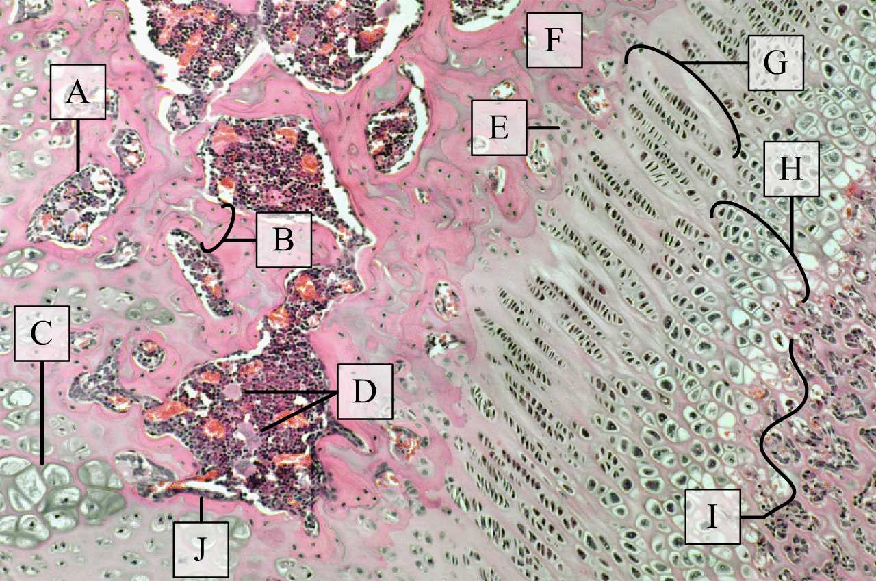 Epifízis porckorong kis nagyításon (balra a végdarab, jobbra a középdarab) (H-E, Molnár Kinga metszete)