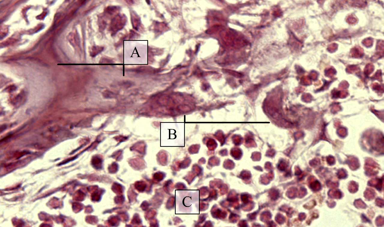 Sokmagvú csontfaló sejtek csontgerenda felszínén (fejlődő csont) (H-E, Zboray Géza metszete)
