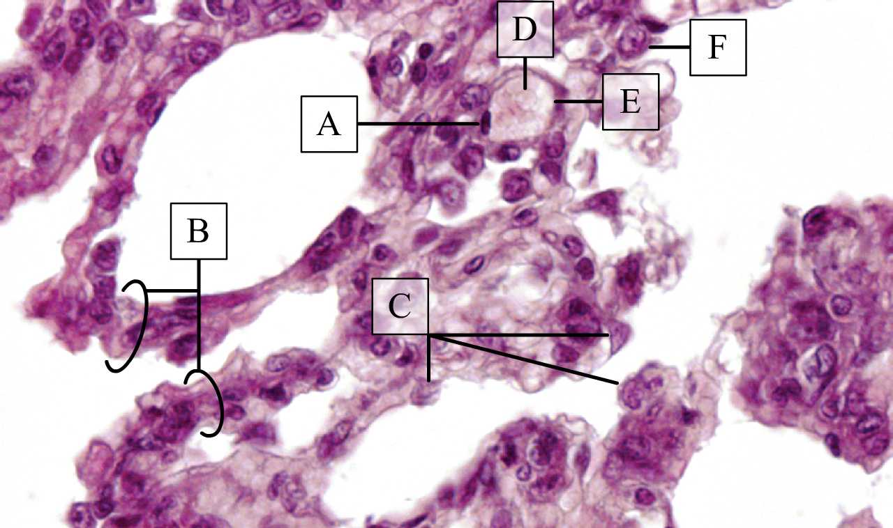 Léghólyagocskák megjelenése összeesett tüdő metszetén (patkány, H-E)