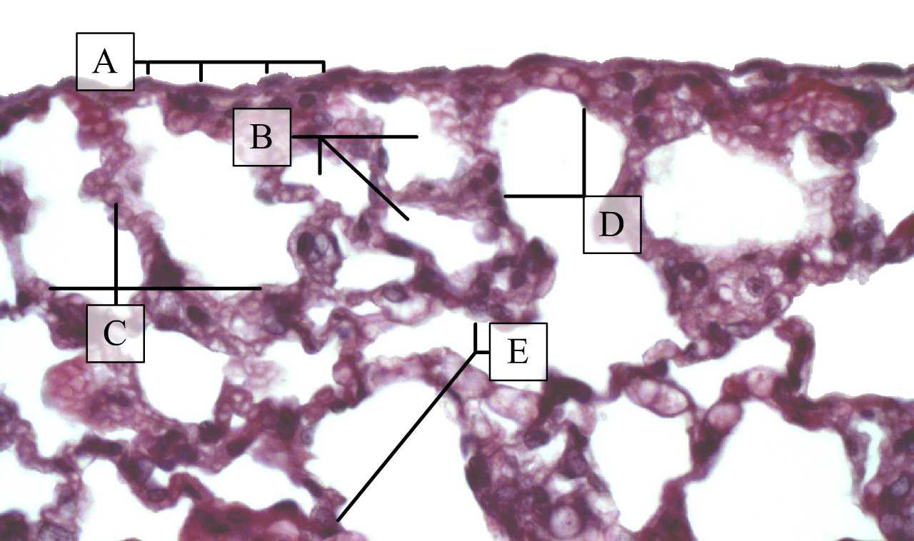 A tüdő külső felszínét borító mellhártya és környezete (patkány, H-E)